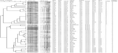 Isolation and Characterization of Clinical Listeria monocytogenes in Beijing, China, 2014–2016